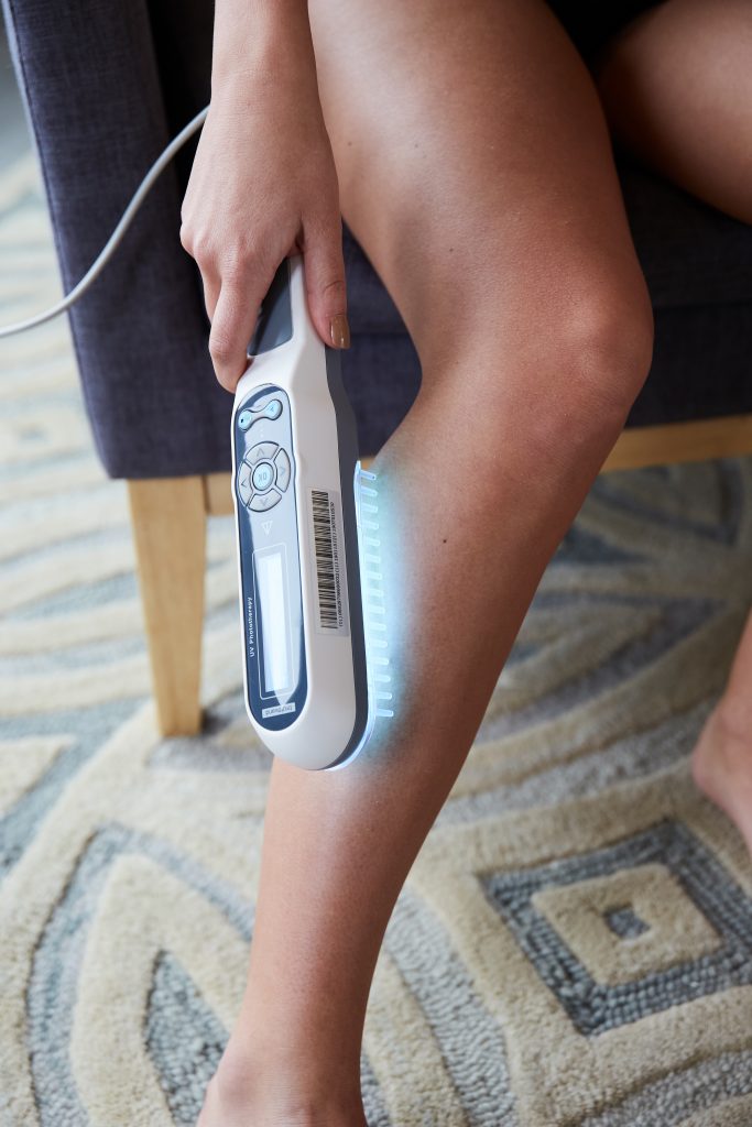 woman holding phototherapy device shining light on leg